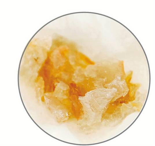 7·13瑞安注胶虾事件