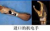 肌电假手