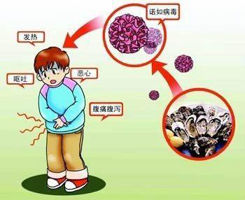 12·25广州81名学生诺如病毒感染事件