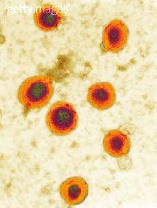 慢性化脓性腮腺炎