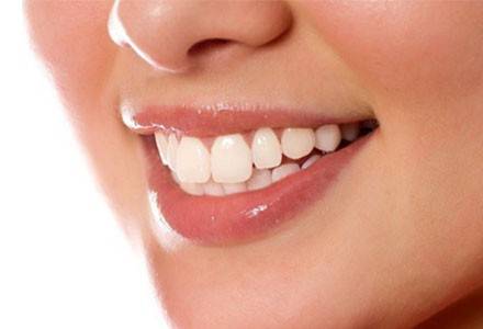 激光美白牙