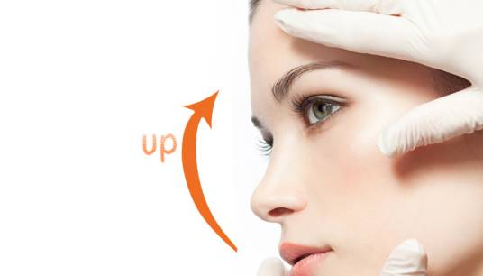 面部提升术