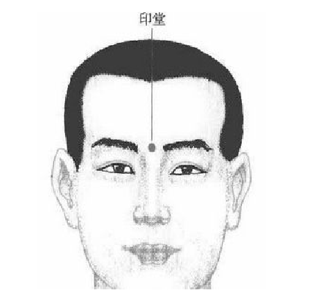 印堂发黑