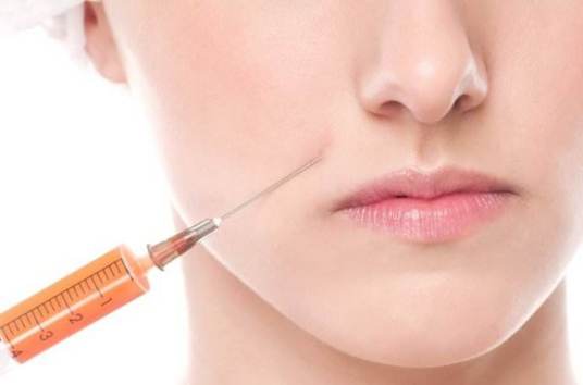 玻尿酸面部填充术