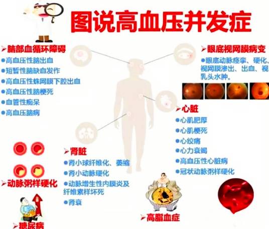 高血压并发症