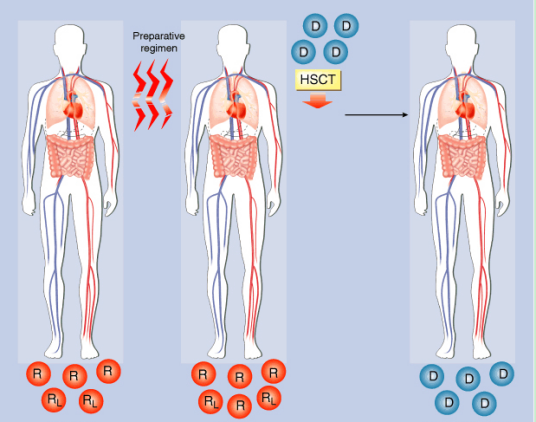 干细胞移植（未充分分化不成熟的细胞）