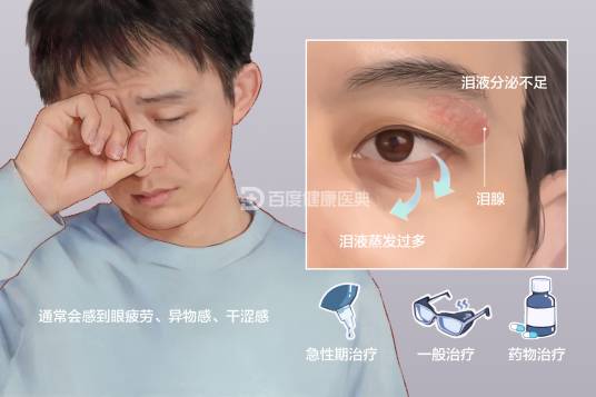 干眼症（角结膜干燥症）