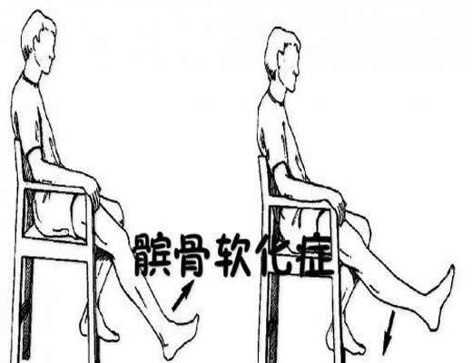 膝关节髌骨软化