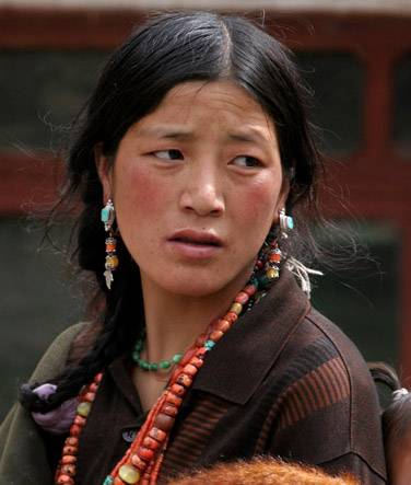 高原红（医学名词）