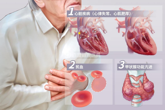 心悸（中医病证名）
