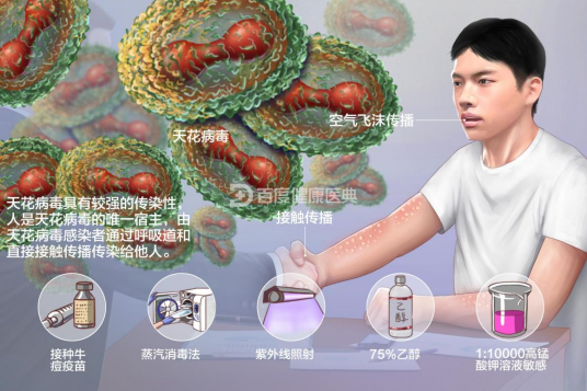 天花（由天花病毒感染人引起的烈性传染病）