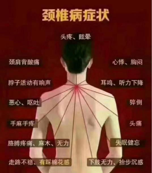 颈椎病的临床表现