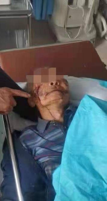 5·8石家庄野猪伤人事件