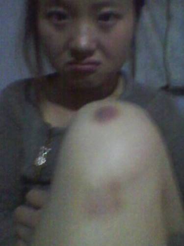 李洪娜（内蒙古赤峰吸毒者）