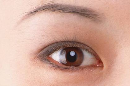 生物焊接双眼皮