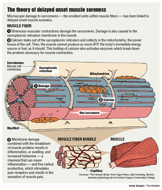 延迟性肌肉酸痛