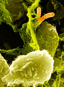 Nets（中性粒细胞胞外杀菌网络）