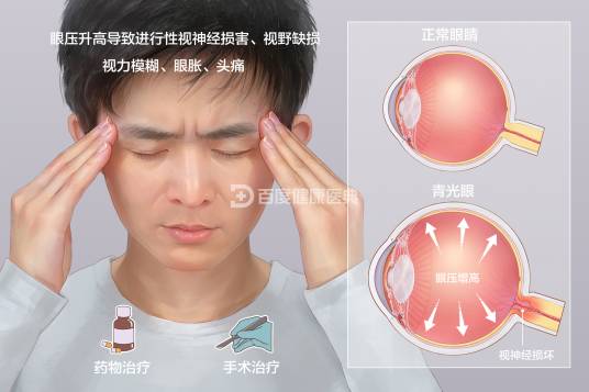 青光眼（疾病名称）