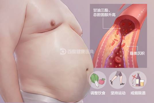 高脂血症（医学术语）