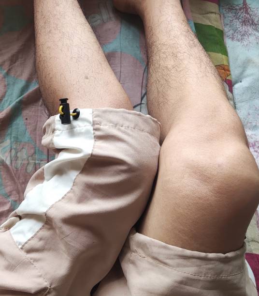 腿毛（人体腿部毛发）