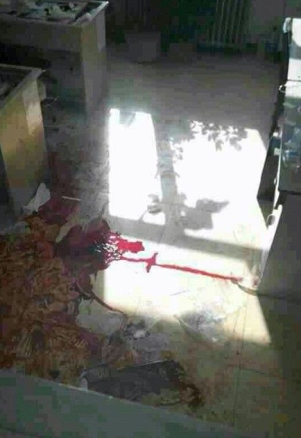 2·18齐齐哈尔杀医案