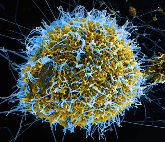 Virus（电脑病毒）