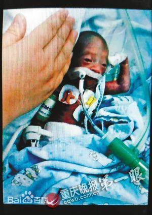 李思源（筷子宝宝）