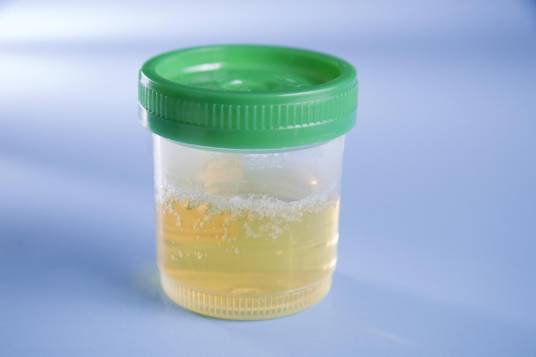 尿液