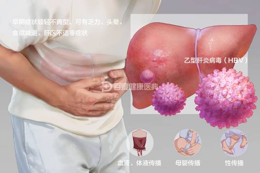 慢性乙型肝炎