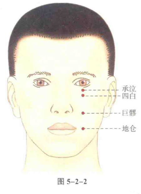 承泣（人体腧穴）